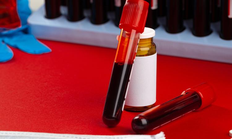 Nouvelle grève des laboratoires de biologie médicale jusqu’au 15 janvier